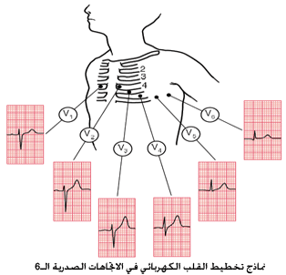 شرح تخطيط القلب الكهربائي ECG وتحديد الحالة من رسم القلب 6-thoracic-lead